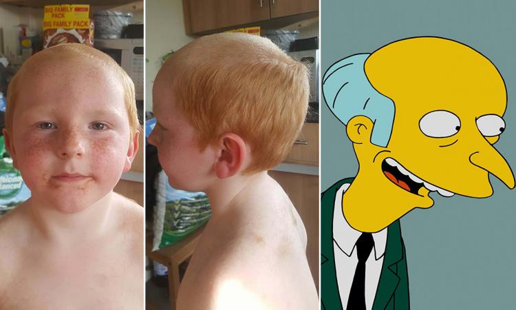 Petit garçon crâne rasé