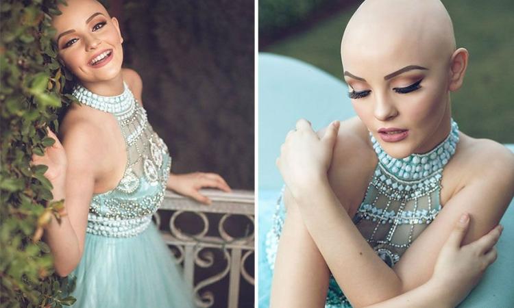 perte cheveux andrea sierra princesse