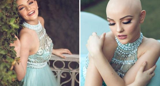 perte cheveux andrea sierra princesse