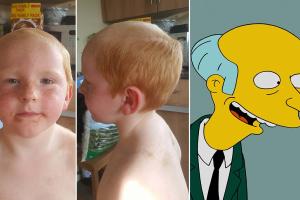 Petit garçon crâne rasé