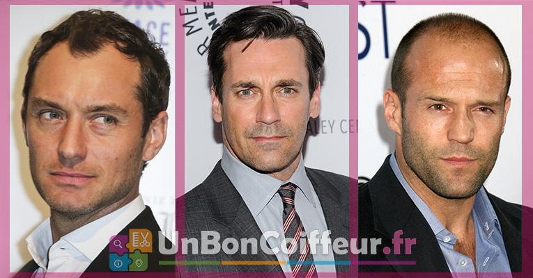 Quelle Coupe Quand On Perd Ses Cheveux Homme Les coiffures adaptées à la perte de cheveux